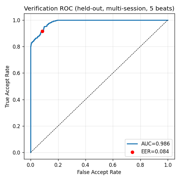 ROC curve for verification, cross-day, 5 beats, held-out people. AUC 0.986, EER point marked at 0.084